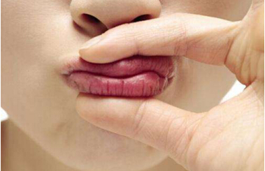 Ƽ|blistexС׹ܣרҵںٸɵĿںҲ